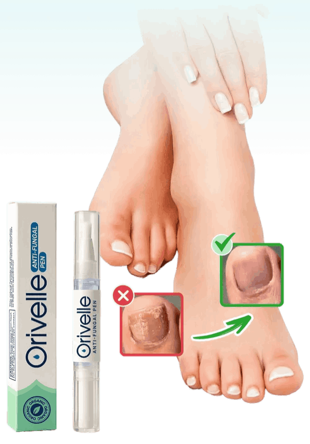 Orivelle Nail Fungus Pen – Official Site – Orivele